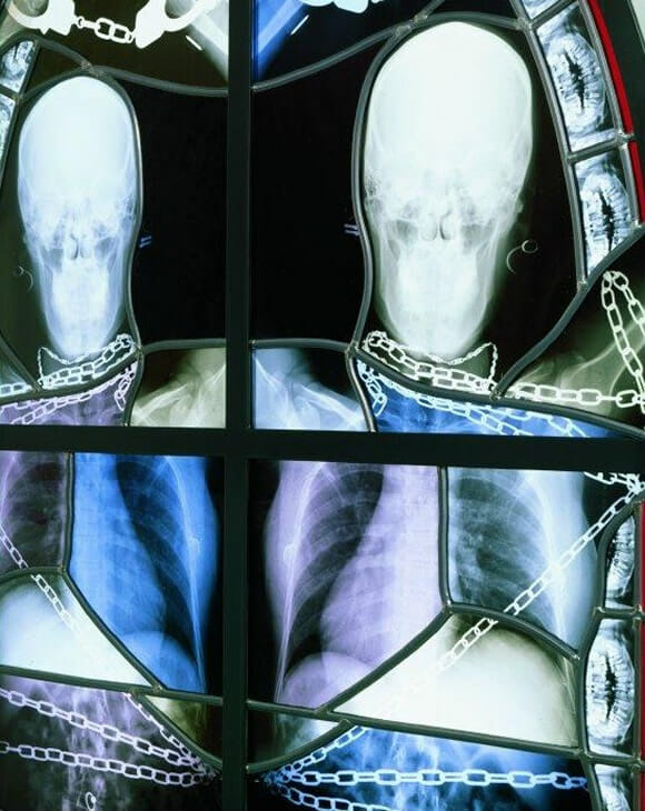 Vitrais bizarros decorados com imagens de esqueletos humanos. #MUAHAHA!