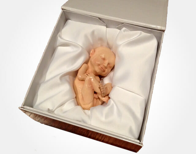 BIZARRO! Empresa vende réplicas de fetos de bebês em 3D para os pais