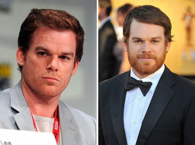 25 Antes e depois de famosos mostram o poder que a barba tem