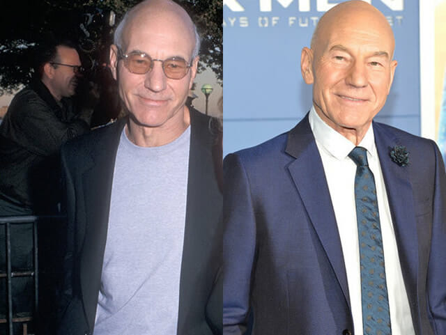 Após 14 anos, antes e depois compara 7 atores que fazem parte do elenco do filme X-Men