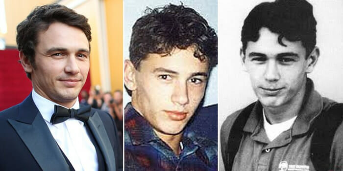 Antes e depois mostra como eram 21 atores famosos na época do colégio