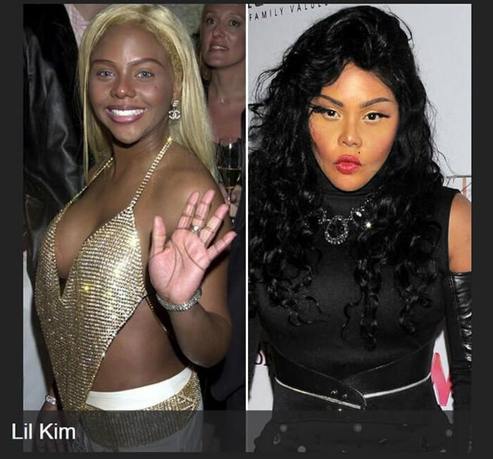 22 Celebridades antes e depois de cirurgias plásticas
