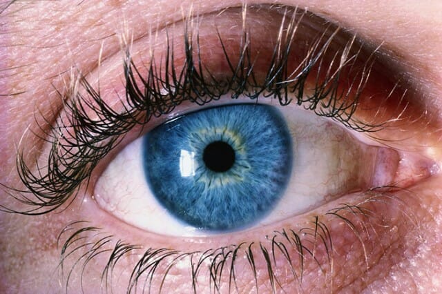 6 Fatos Interessantes Sobre Cores de Olhos Raras Que Você Provavelmente Não Sabe