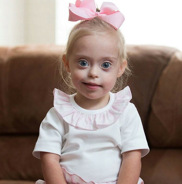 Garota com Síndrome de Down de 2 anos de idade fecha contrato com agência de modelos graças ao seu lindo sorriso