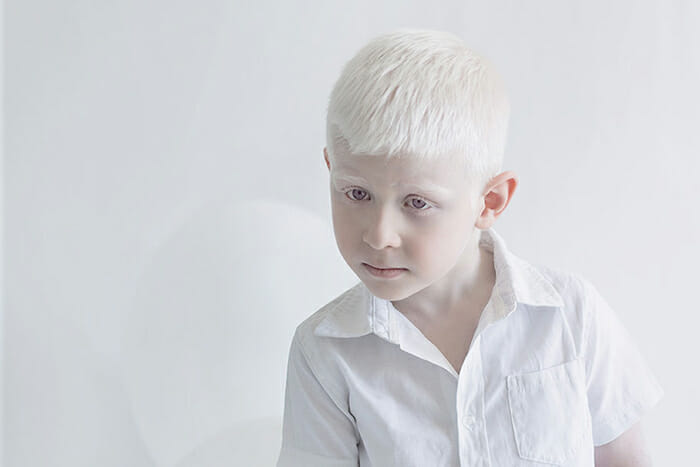 beleza-hipnotizante-albinos_9